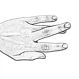 MP Deviation hand graphic