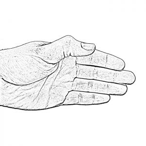 Thumb MCP hand graphic