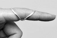 SilverRing™ Swan Neck Splint shown on the DIP joint